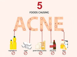 Acne Diet: 9 Foods That Cause Pimples(Plus Foods That Clear Them)