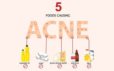 Acne Diet: 9 Foods That Cause Pimples(Plus Foods That Clear Them)