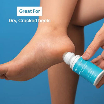 20% Urea Cracked Heel Roll-On