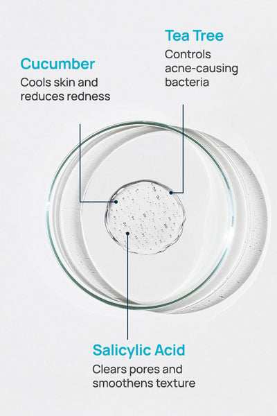 Acne-Limit Facial Toner