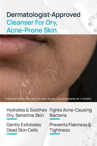 AcneShield Facial Cleanser With 0.1% Aloe Vera & 0.1% Willow Bark
