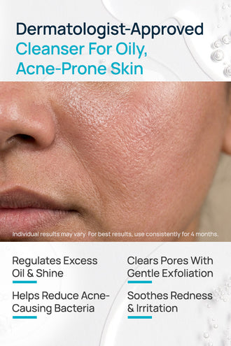 Acne Shield Facial Cleanser For Oily SkinAcneShield Facial Cleanser With 0.1% Glycolic Acid & 0.1% Neem