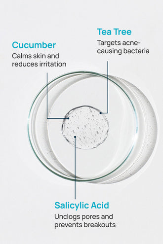 Acne-Limit Facial Toner With 0.1% Cucumber Extract & 0.1% Tea Tree Extract