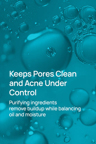 Acne-Limit Facial Toner With 0.1% Cucumber Extract & 0.1% Tea Tree Extract