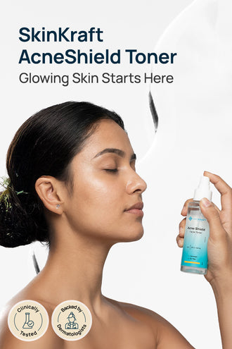 Acne-Limit Facial Toner With 0.1% Cucumber Extract & 0.1% Tea Tree Extract