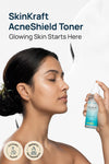 Acne Shield Facial Toner