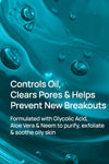 Acne Shield Facial Cleanser For Oily Skin