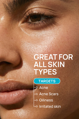 Acne Control Combo With 0.1% Tea Tree Extract and 1% Ceramides For Oily Skin