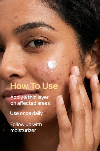 Acne Exfoliating Facial Cream With 5% Azelaic Acid & 5% Niacinamide