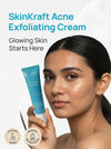 Acne Exfoliating Facial Cream