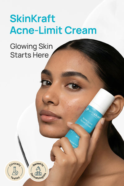 Acne-Limit Facial Cream