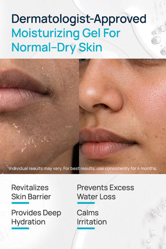Barrier Repair Moisturizing Gel With 0.5% Vitamin E & 1% Ceramides