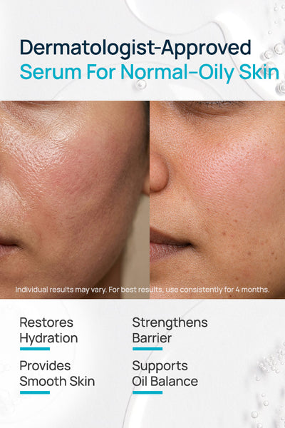 Barrier Repair Serum