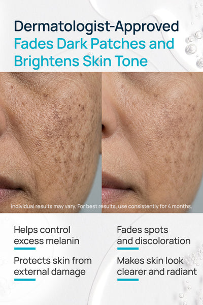 Niacinamide With Licorice Depigmentation Serum