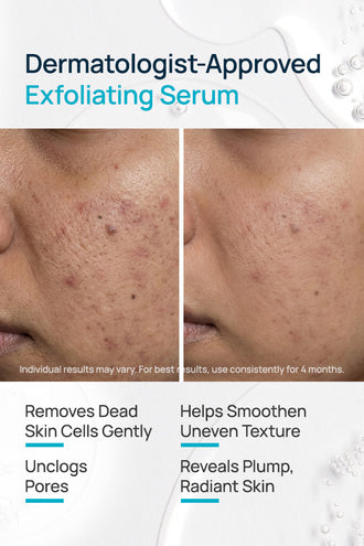 Re-Texturizing Facial Serum With 10% Vitamin C & 9% AHA BHA