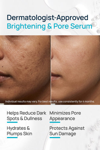 Pore-Free Facial Serum With 10% Vitamin C & Hyaluronic Acid