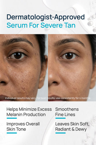 Skin Plumping Facial Serum With 4% Niacinamide & 2% Vitamin C