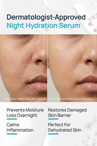 Hyaluronic Skin Drench Night Serum With Sodium Hyaluronate & Sodium PCA