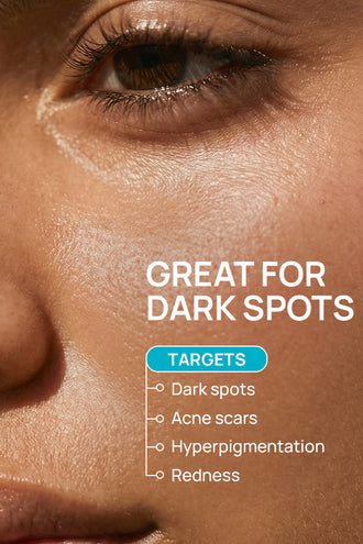 Dark Spot Combo With 2% Kojic Dipalmitate and 0.1% Neem For Sensitive Skin