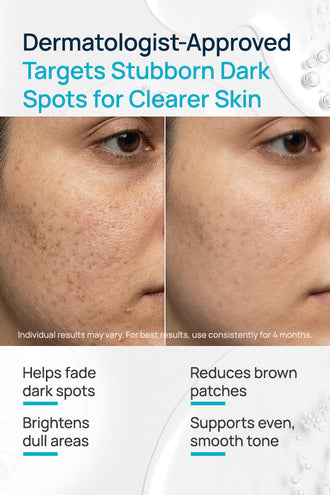 Correxion Spot Rectifying Facial Serum With 2% Kojic Dipalmitate & 5% Niacinamide