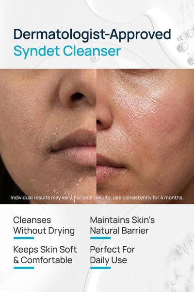 Syndet Face Cleanser