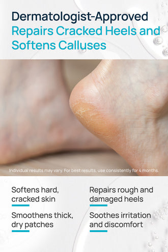 20% Urea Cracked Heel Roll-On With 20% Urea & Lactic Acid