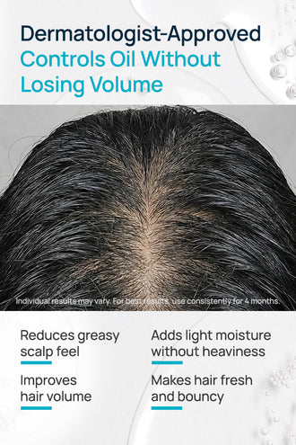 Volume Boost Oil Control Shampoo With D-Panthenol & Sunflower Seed Oil