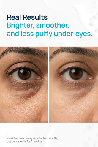 Retinol & Caffeine Under Eye Youthful Glow Gel